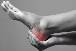 Plantar Fasciitis Home Remedies: Natural Ways to Relieve Heel Pain Fast
