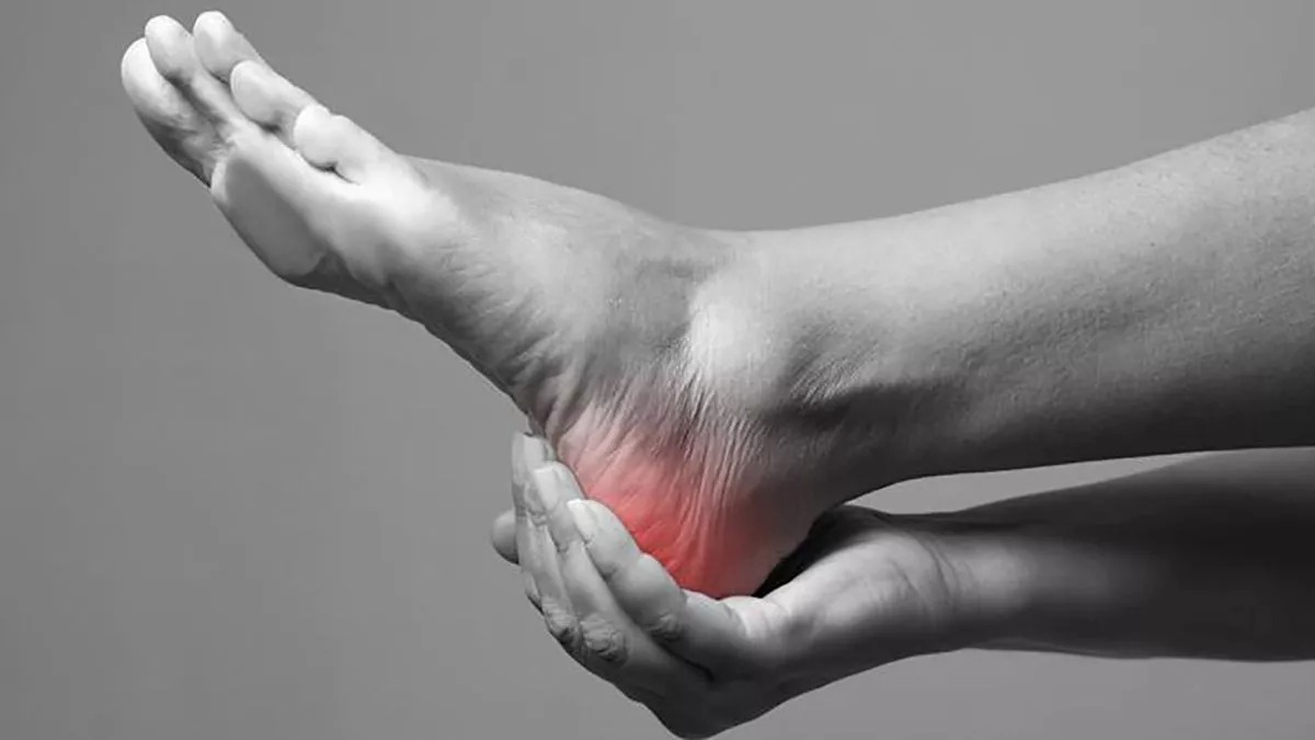 plantar fasciitis home remedies